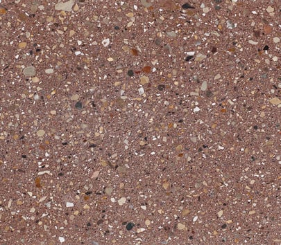 Sunrise (63-242A) preload